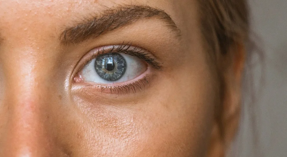 Sécheresse oculaire en hiver : découvrez les causes des yeux secs et les solutions efficaces pour retrouver confort et protection durant la saison froide.